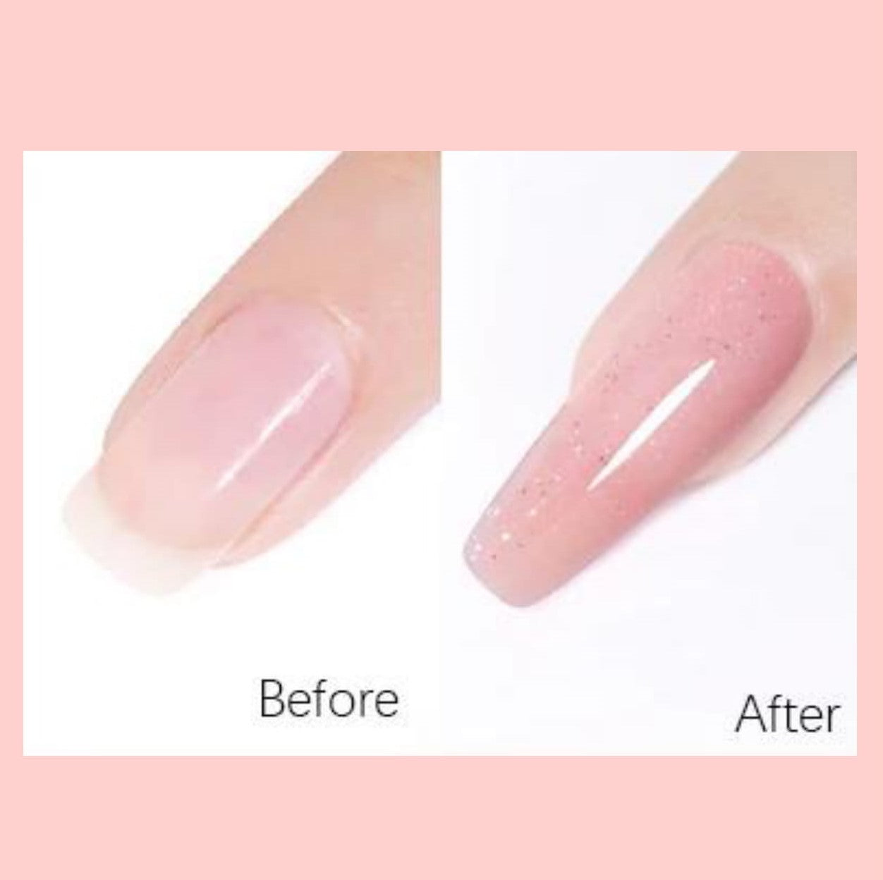 Extension gel - Set